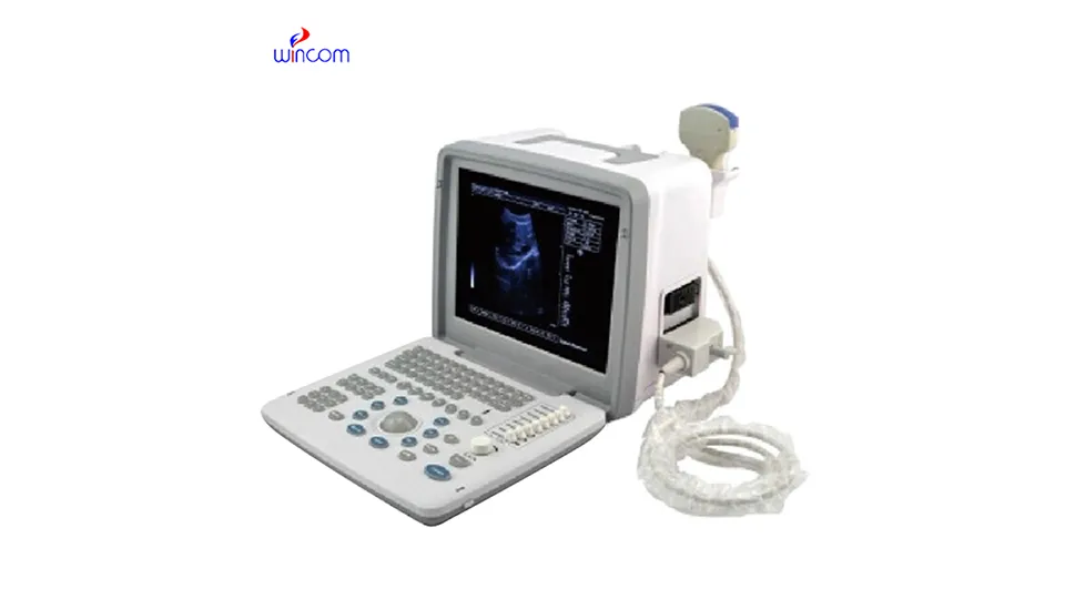 B-ultrasound